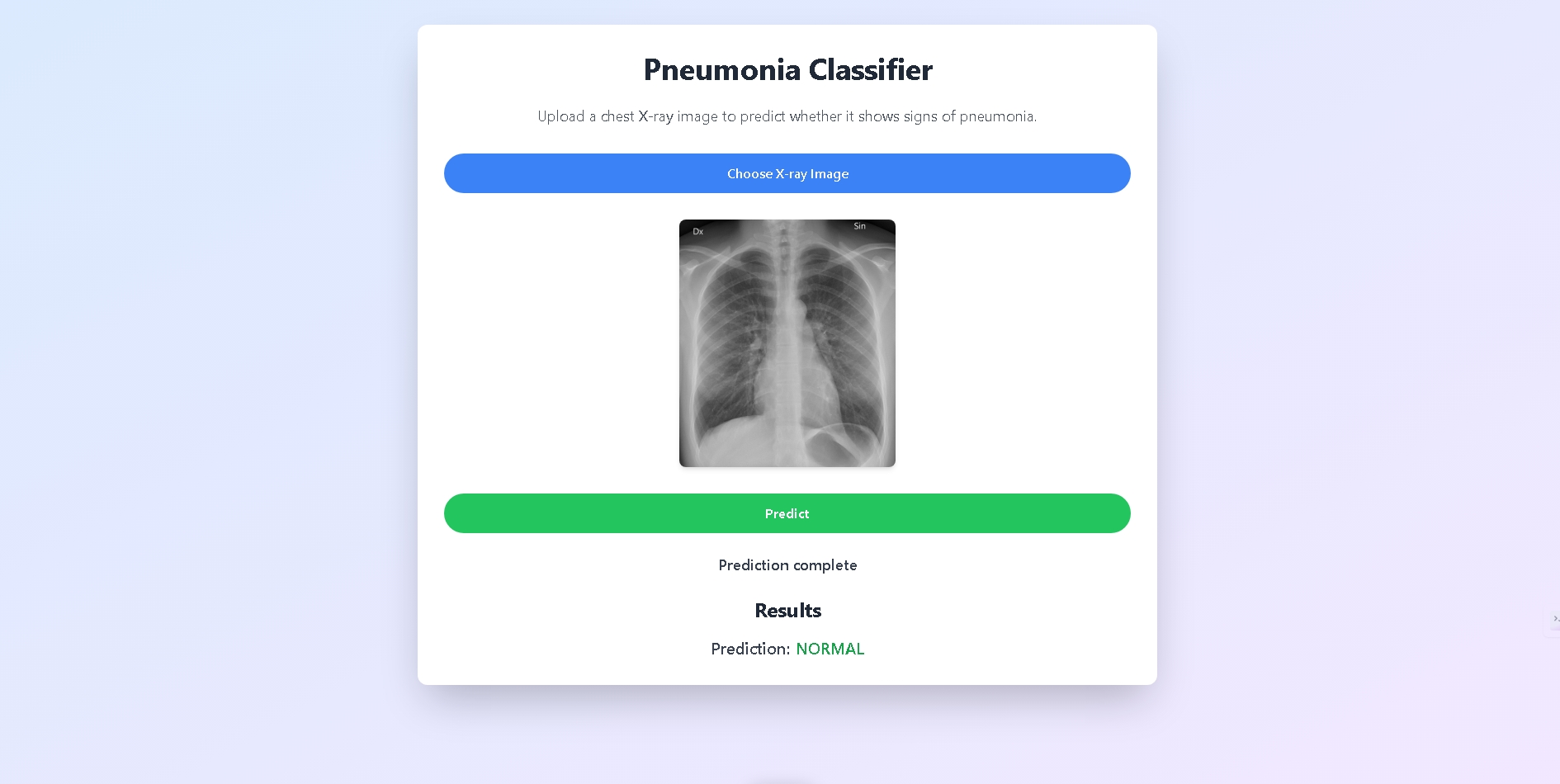 Pneumonia Classifier with Next.js